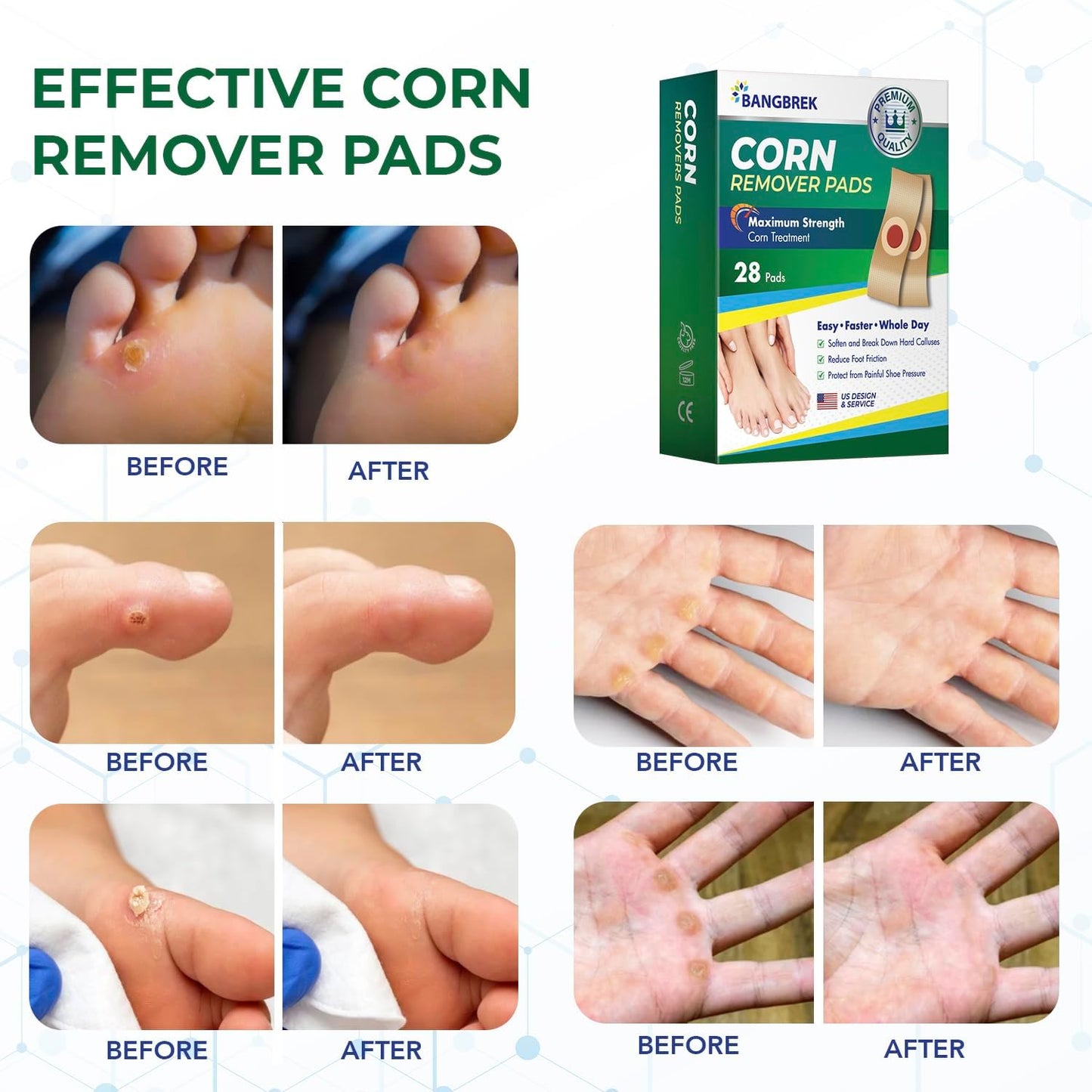 Corn Removers for Feet Extra Strength