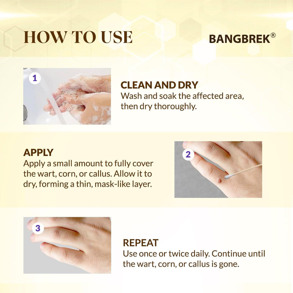 Bee Venom Wart Remover: Fast Acting Wart Remover Freeze Off for Plantar Common Flat Wart Corn Callus Removers for Toes Feet - Maximum Strength Salicylic Acid Wart Corn Callus Removers (1 FL OZ))