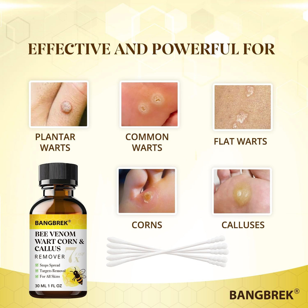 Bee Venom Wart Remover: Fast Acting Wart Remover Freeze Off for Plantar Common Flat Wart Corn Callus Removers for Toes Feet - Maximum Strength Salicylic Acid Wart Corn Callus Removers (1 FL OZ))